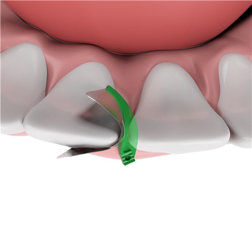 OnTeeth Topdown